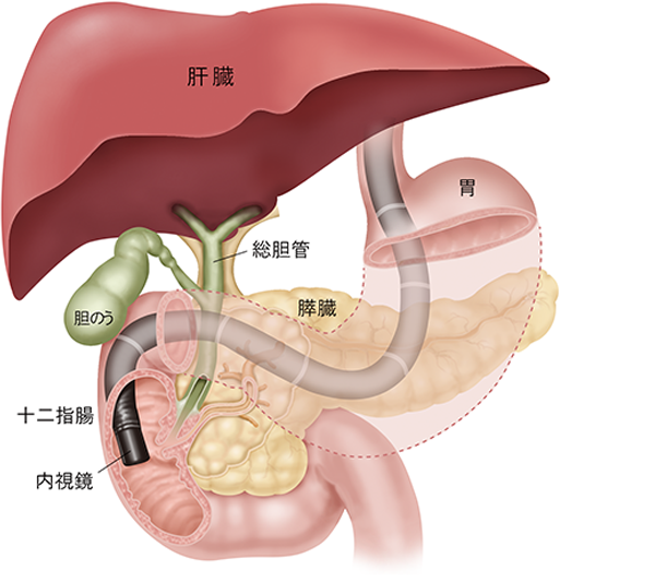 医療イラストレーション